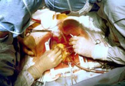 Doktor hataları hastalıklar kadar ölümcül